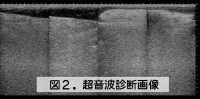 超音波診断画像