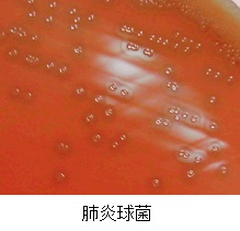 肺炎球菌