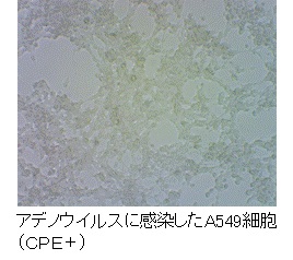 アデノウイルスに感染したA549細胞(CPE＋)